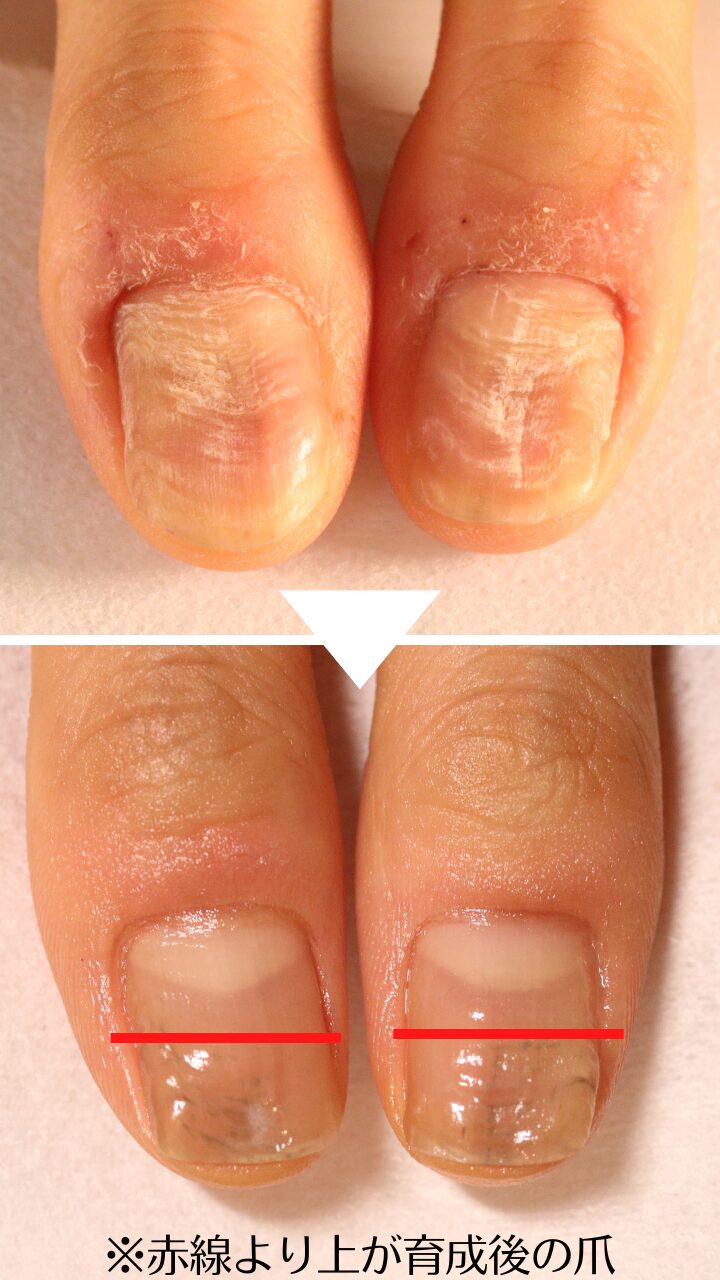 大宮ネイルサロン｜美爪ネイルケア専門店のフラン