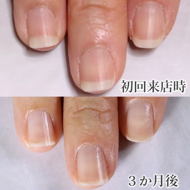 大宮ネイルサロン｜美爪ネイルケア専門店のフラン