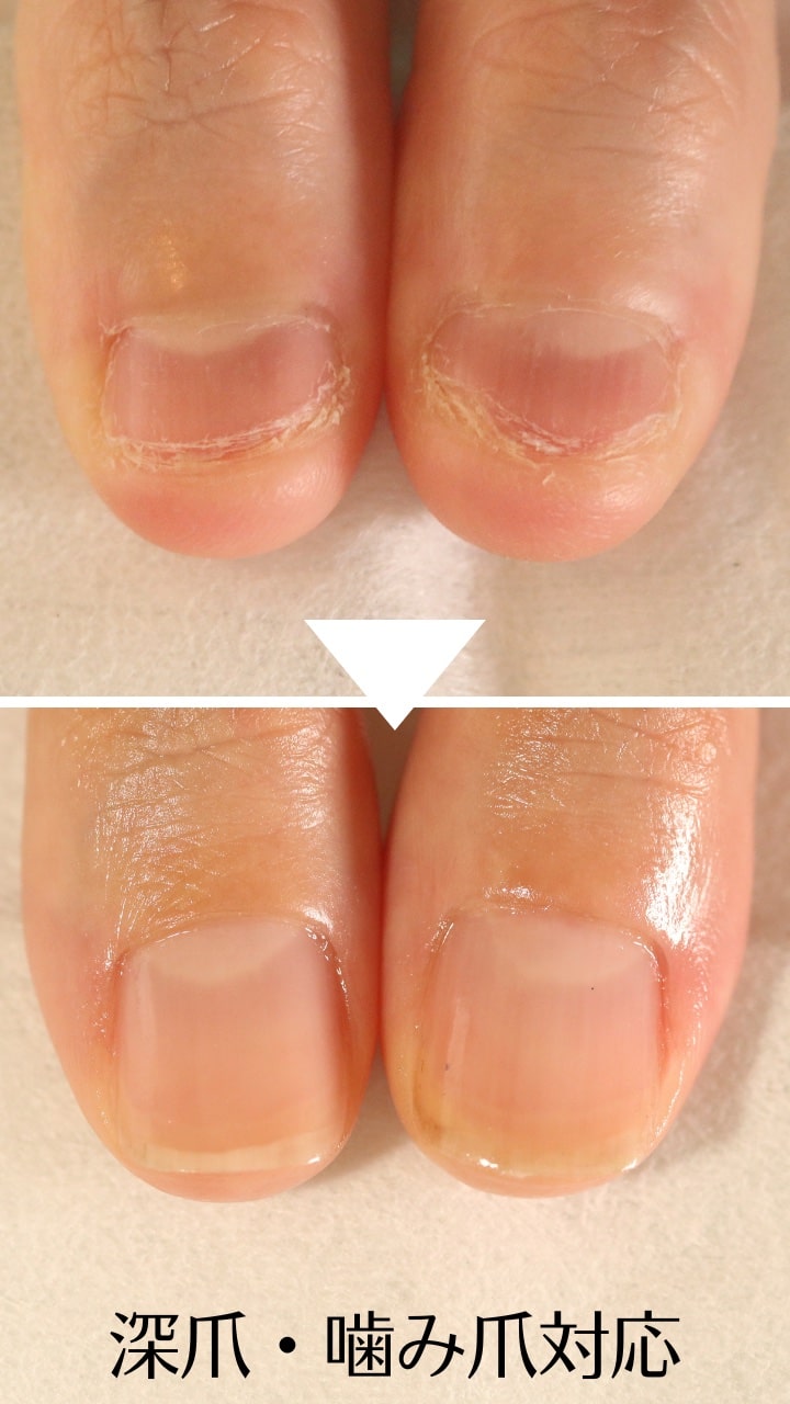 大宮ネイルサロン｜美爪ネイルケア専門店のフラン