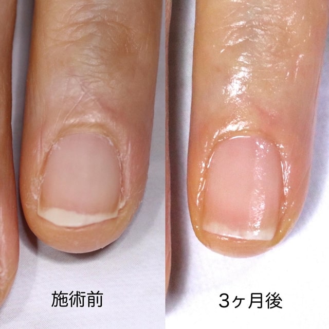 大宮ネイルサロン｜美爪ネイルケア専門店のフラン