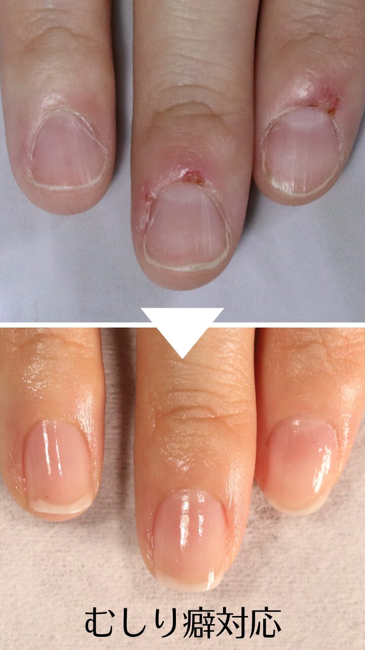 大宮ネイルサロン｜美爪ネイルケア専門店のフラン