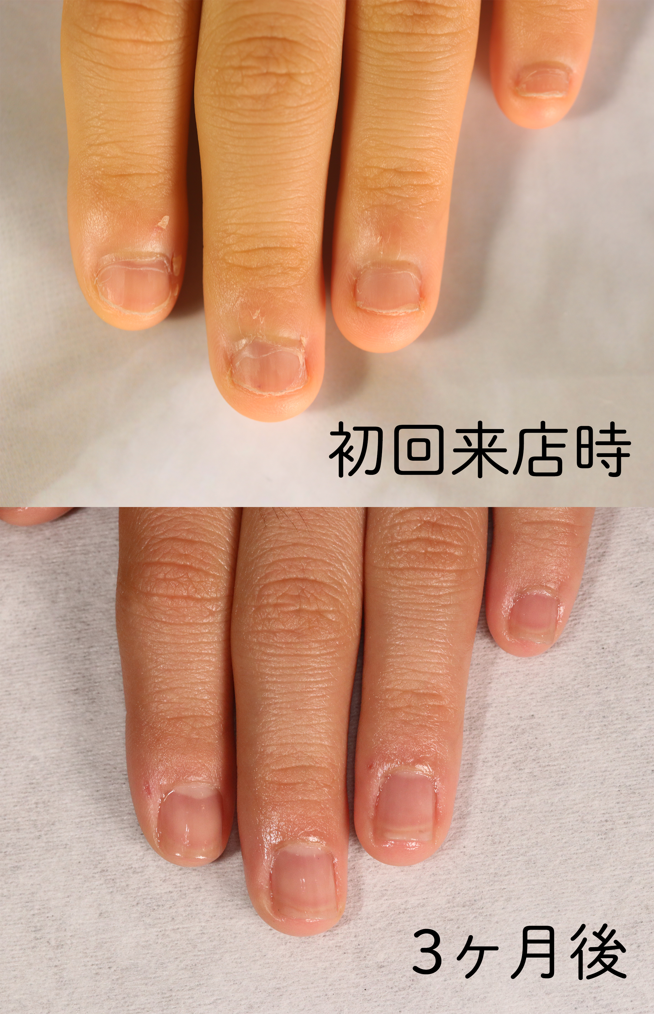 大宮ネイルサロン｜美爪ネイルケア専門店のフラン