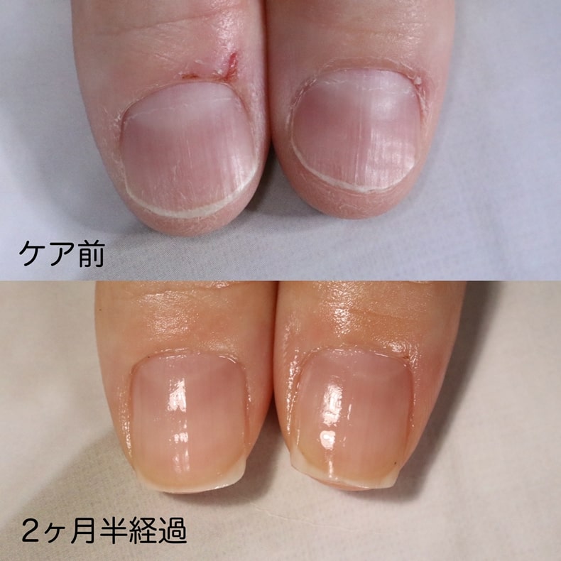 大宮ネイルサロン｜美爪ネイルケア専門店のフラン