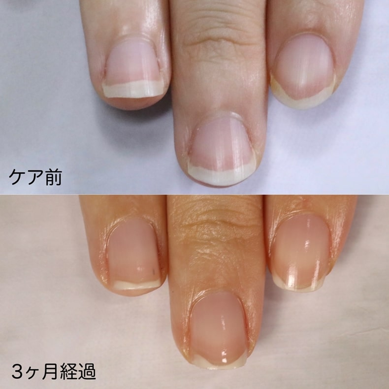 大宮ネイルサロン｜美爪ネイルケア専門店のフラン