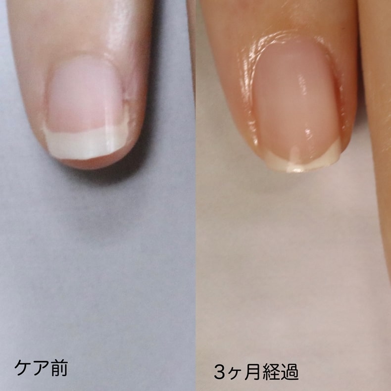 大宮ネイルサロン｜美爪ネイルケア専門店のフラン