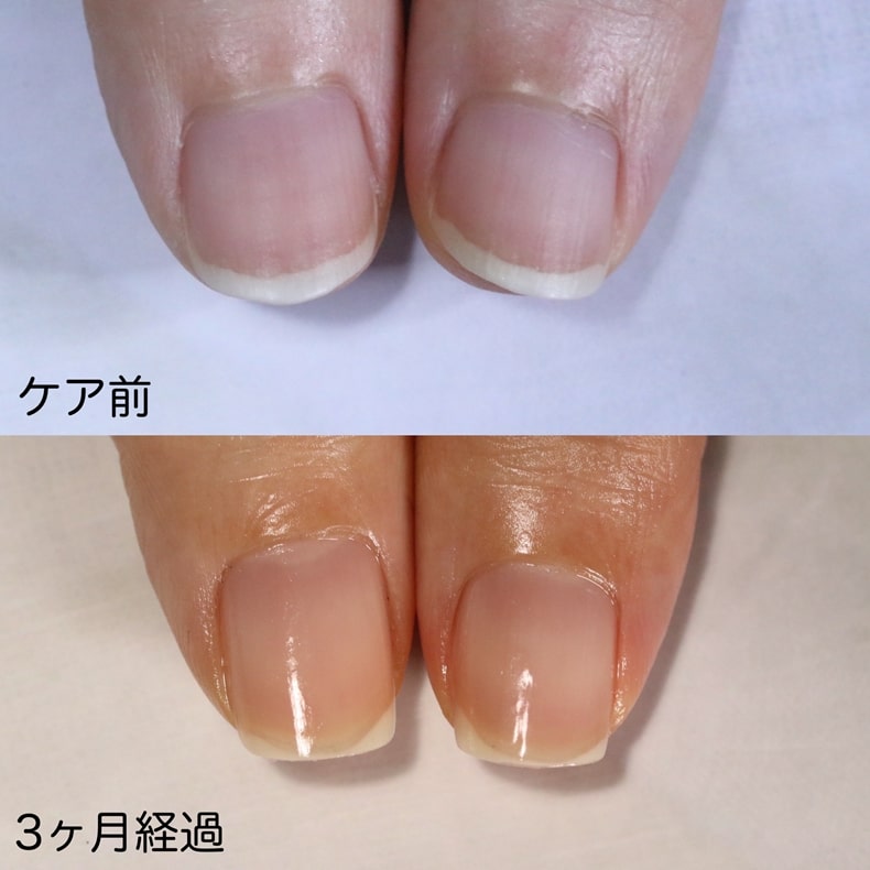 大宮ネイルサロン｜美爪ネイルケア専門店のフラン