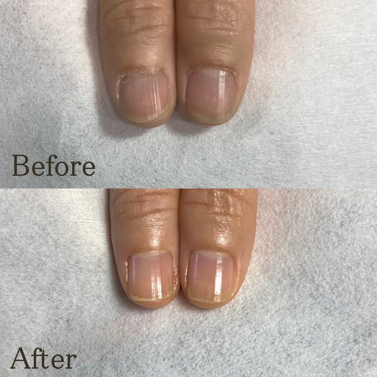 大宮ネイルサロン｜美爪ネイルケア専門店のフラン