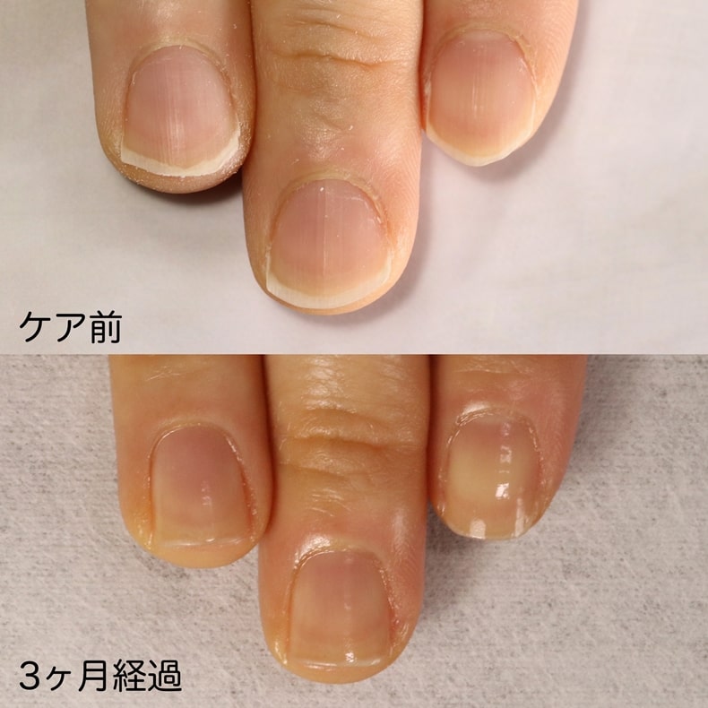 大宮ネイルサロン｜美爪ネイルケア専門店のフラン