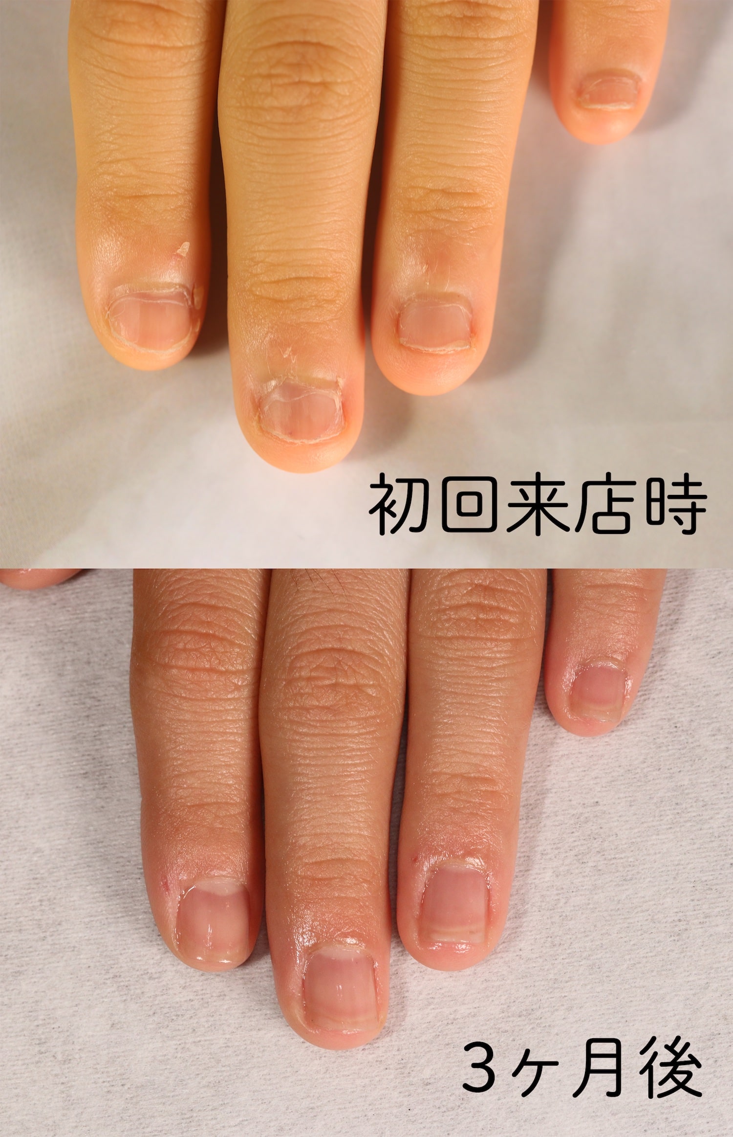 大宮ネイルサロン|美爪ネイルケア専門店のフラン